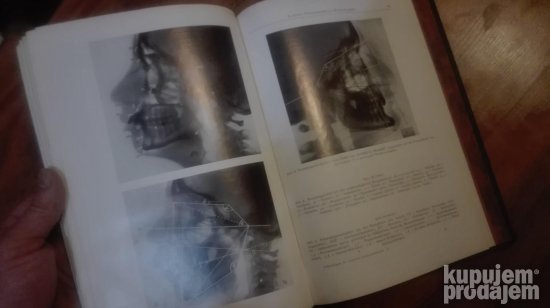 Fortschritte auf dem gebiete der Rontgenstrahlen