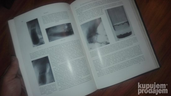 Fortschritte auf dem gebiete der Rontgenstrahlen