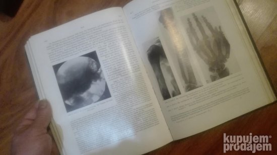 Fortschritte auf dem gebiete der Rontgenstrahlen