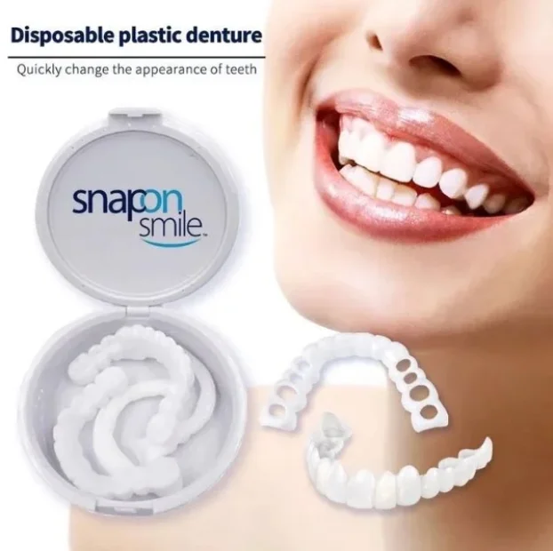 Moderna faseta za savršeno bele zube SNAP ON SMILE