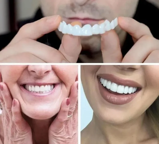Moderna faseta za savršeno bele zube SNAP ON SMILE
