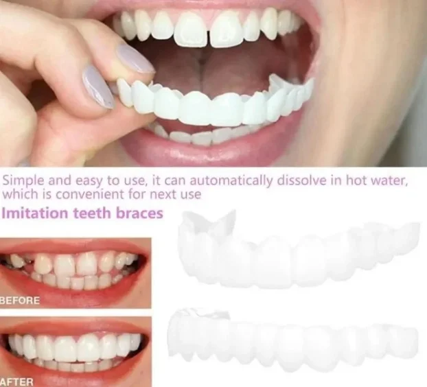 Moderna faseta za savršeno bele zube SNAP ON SMILE