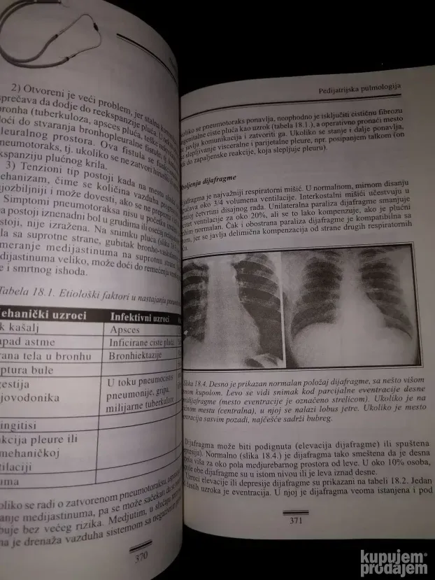 Pedijatrijska pulmologija - Nestorovic Branimir