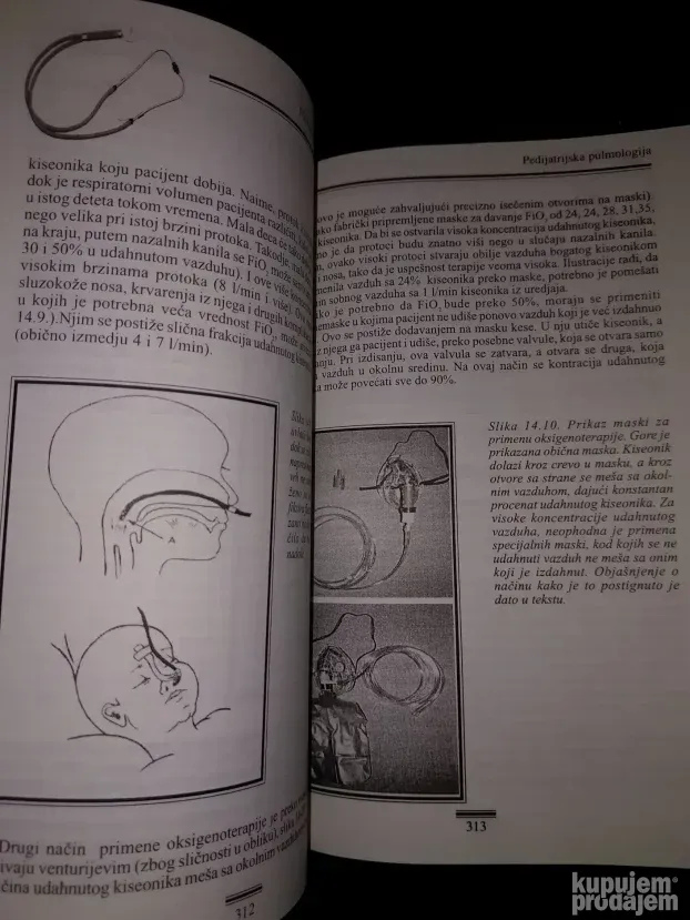 Pedijatrijska pulmologija - Nestorovic Branimir
