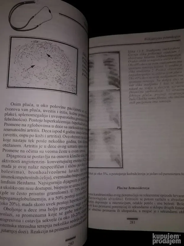 Pedijatrijska pulmologija - Nestorovic Branimir