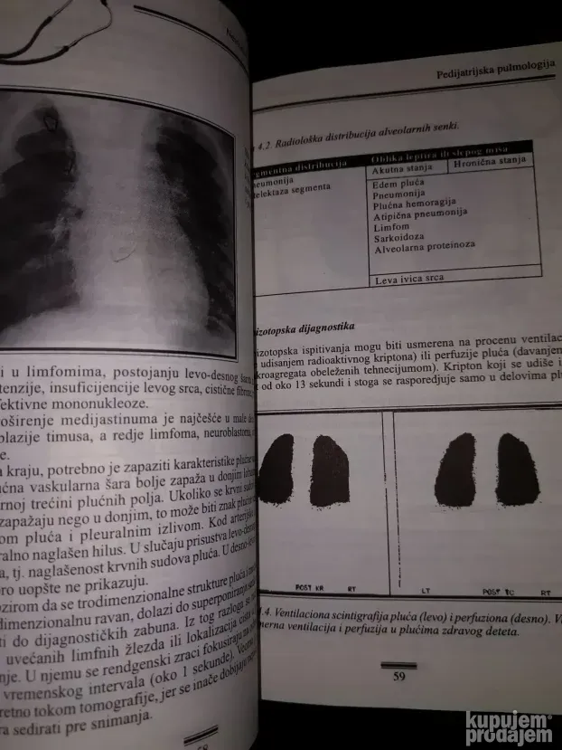 Pedijatrijska pulmologija - Nestorovic Branimir