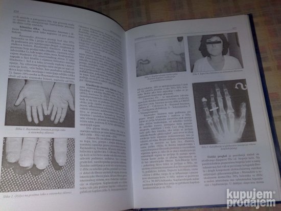 Interna Medicina 2 - Bolesti Aorte, Plucno Srce,