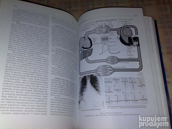 Interna Medicina 2 - Bolesti Aorte, Plucno Srce,