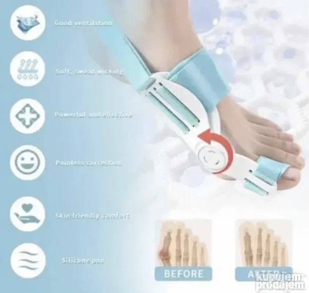 Ispravljac noznih prstiju korektor čukljeva