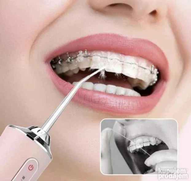 Oralni irigator - električni aparat za čišćenje desni i zuba