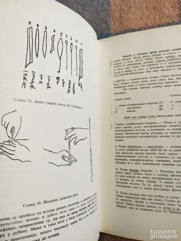 Kineska medicina - Akupunktura, Dr Milan Pavlovic