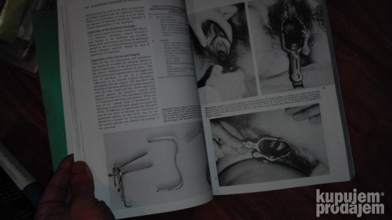 Textbook of Gynaecology - illustrated