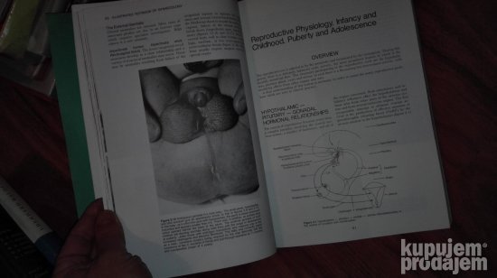 Textbook of Gynaecology - illustrated