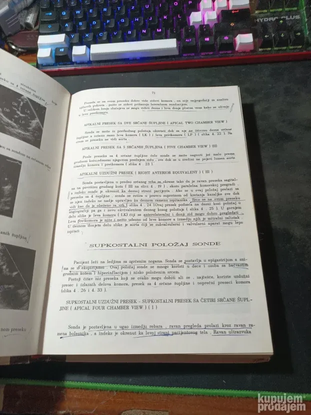 Dr Natalija D.Simin - Ehokardiografija